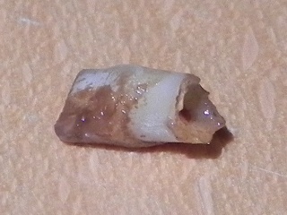 The tooth, image 5